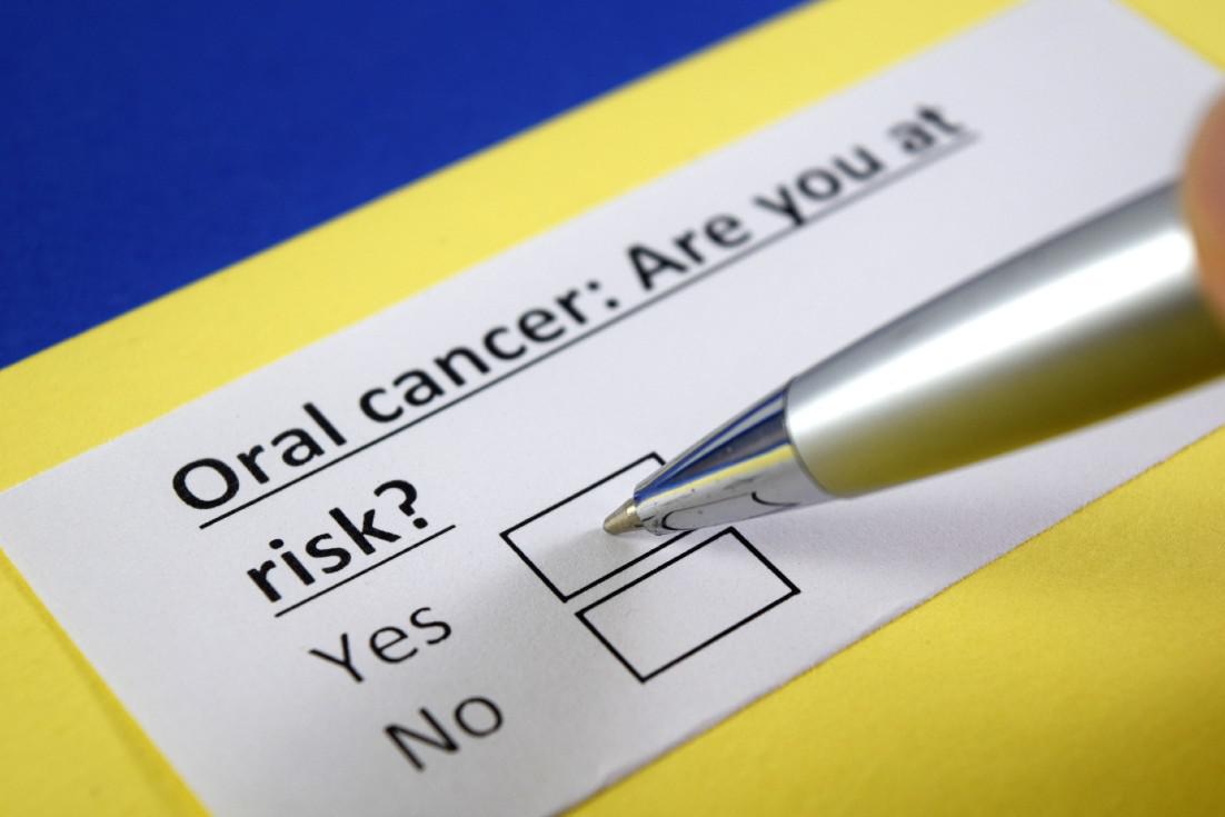 Top 5 Risk Factors for Oral Cancer